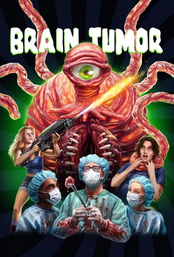 Смотреть Фильм Опухоль мозга(2024) бесплатно